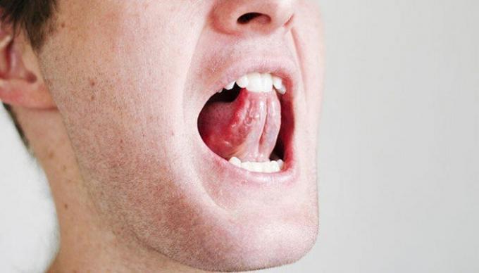 A few simple exercises for the throat and tongue may ease the situation with snoring. / Photo: i2.wp.com. 