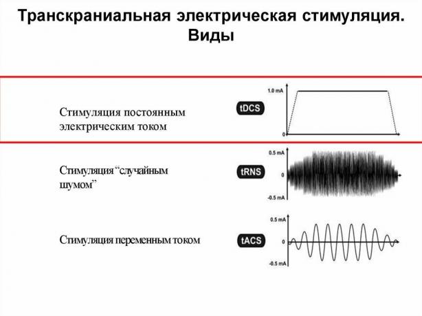 Is it possible to improve memory by electricity?