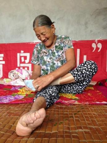 The victims of Chinese beauty, who have surprisingly small feet. / Photo: interesnoznat.com. 