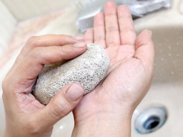 The simplest way to remove superglue from the skin even when it is thoroughly dried out